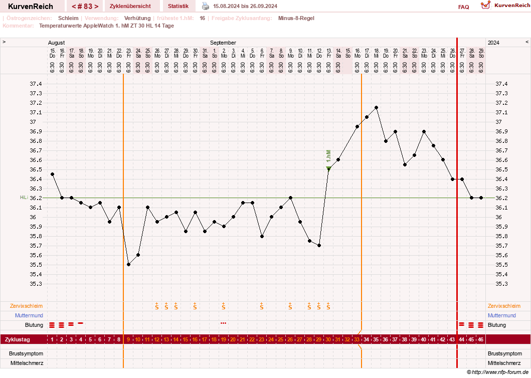 NFP-Kurve User #23416