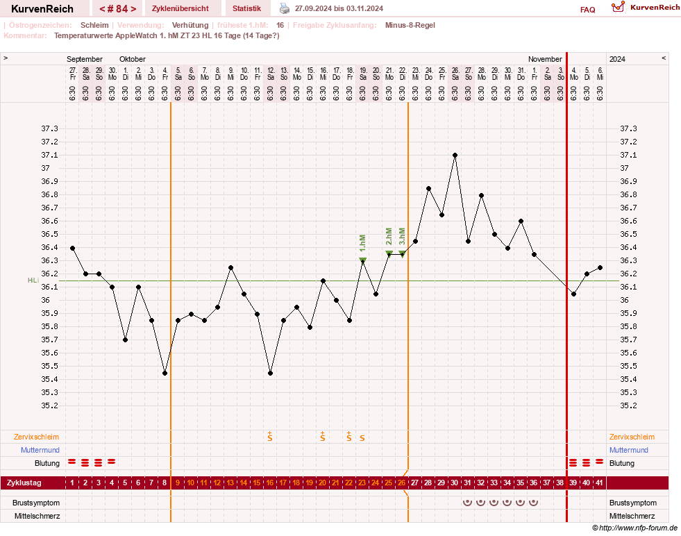 NFP-Kurve User #23416