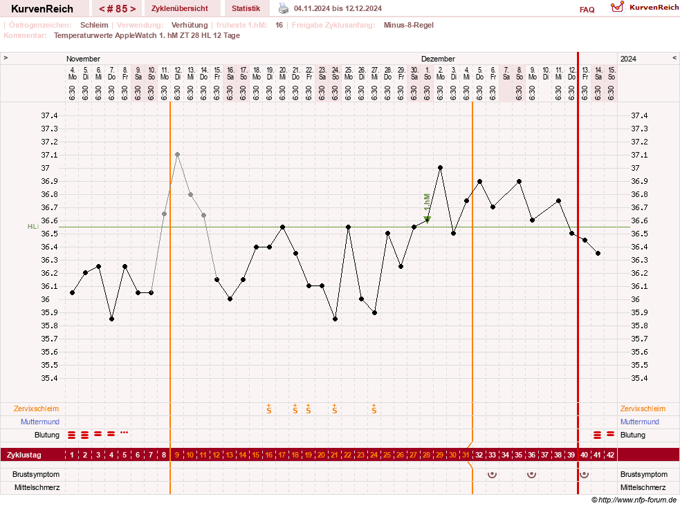 NFP-Kurve User #23416