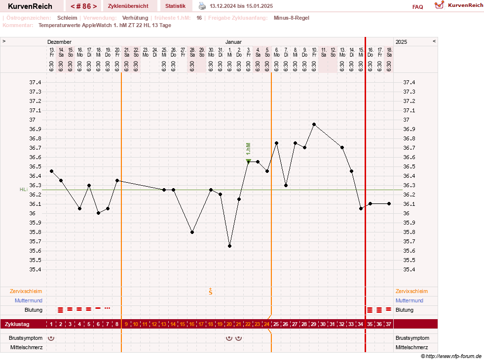 NFP-Kurve User #23416
