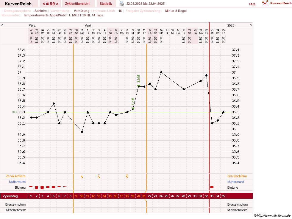 NFP-Kurve User #23416