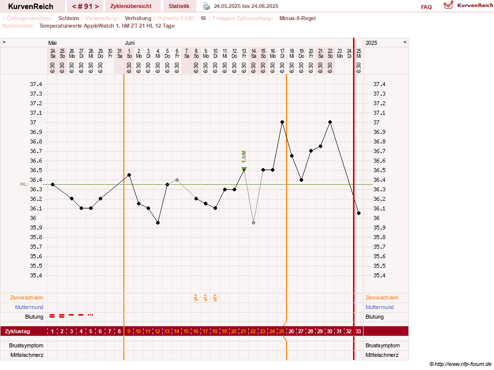 NFP-Kurve User #23416