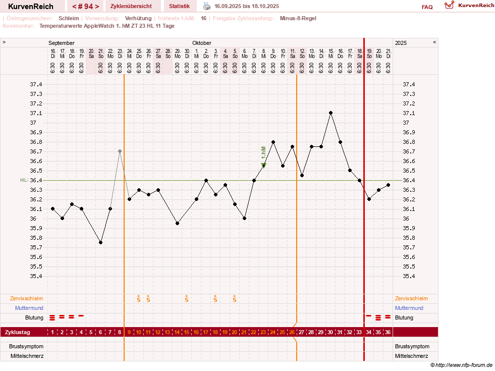 NFP-Kurve User #23416