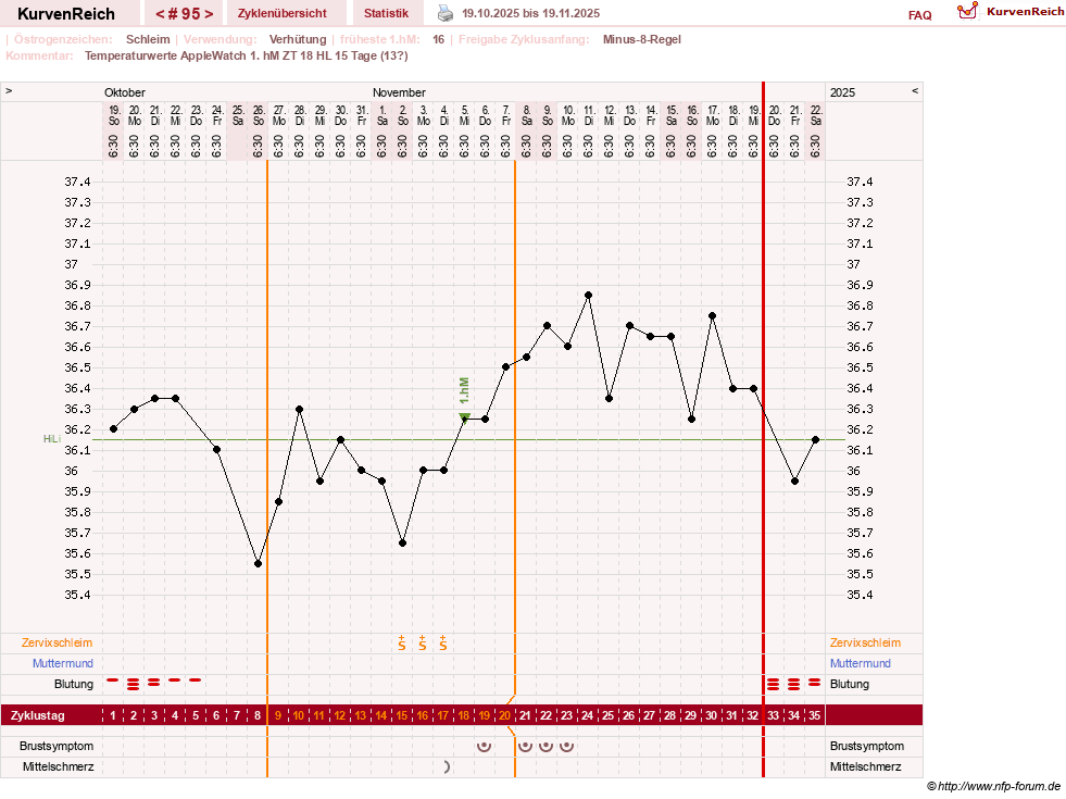 NFP-Kurve User #23416
