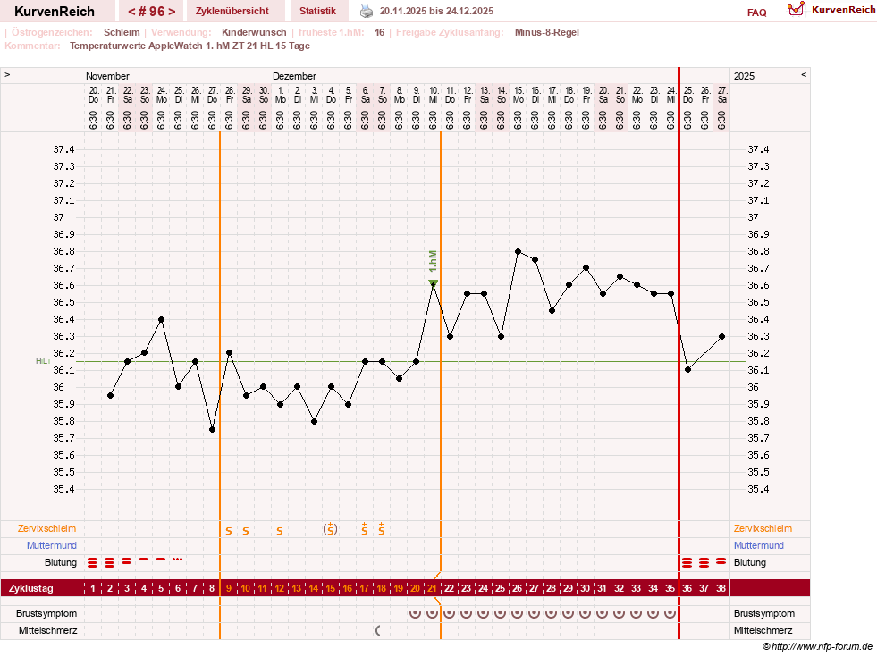 NFP-Kurve User #23416