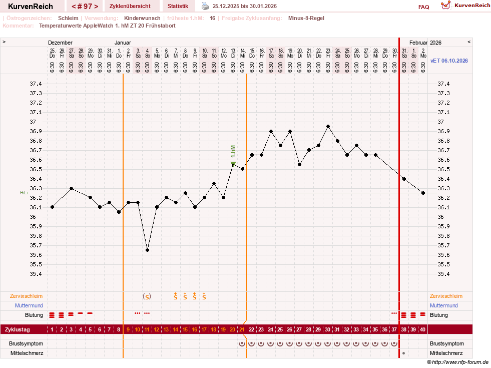 NFP-Kurve User #23416
