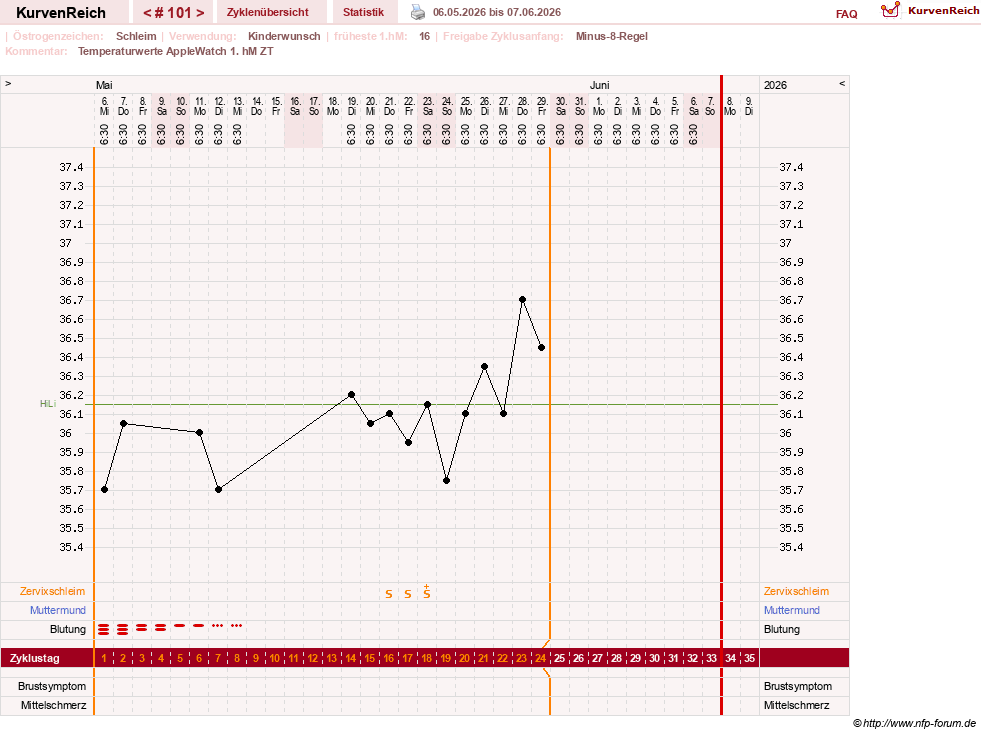 NFP-Kurve User #23416