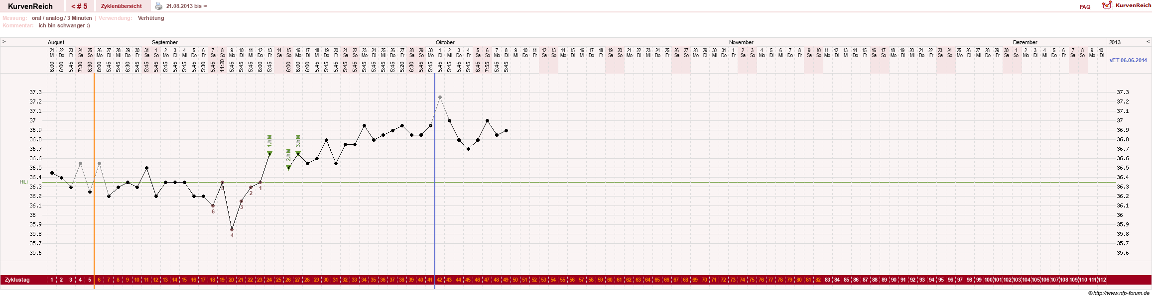 NFP-Kurve User #23677