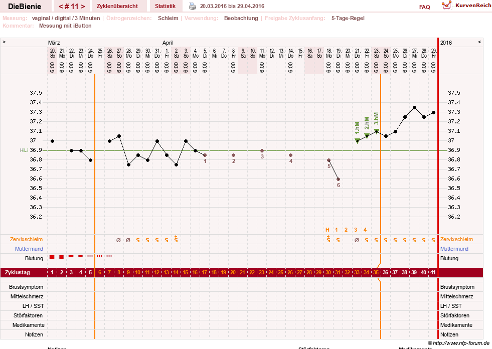 NFP-Kurve User #24048