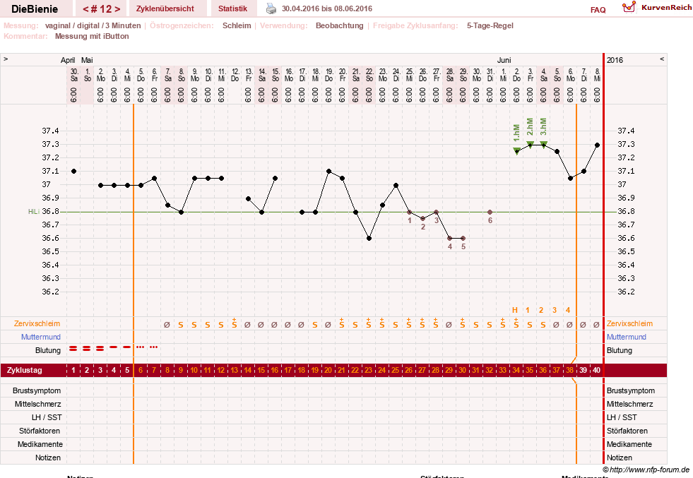 NFP-Kurve User #24048