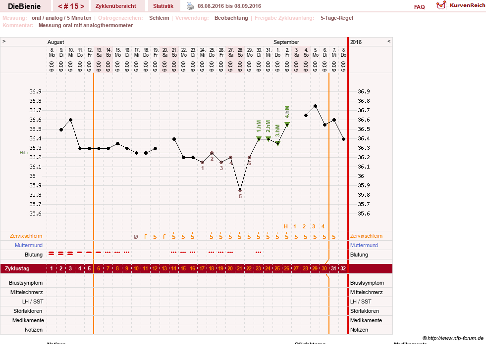 NFP-Kurve User #24048