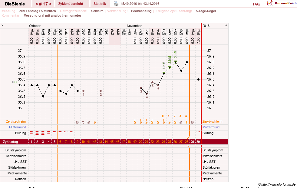NFP-Kurve User #24048