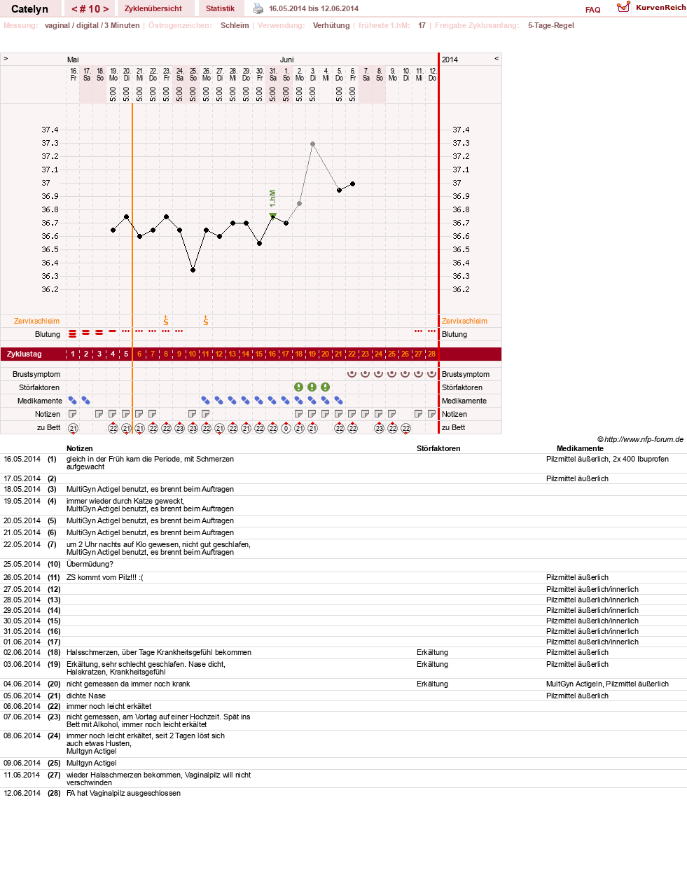 NFP-Kurve User #24125