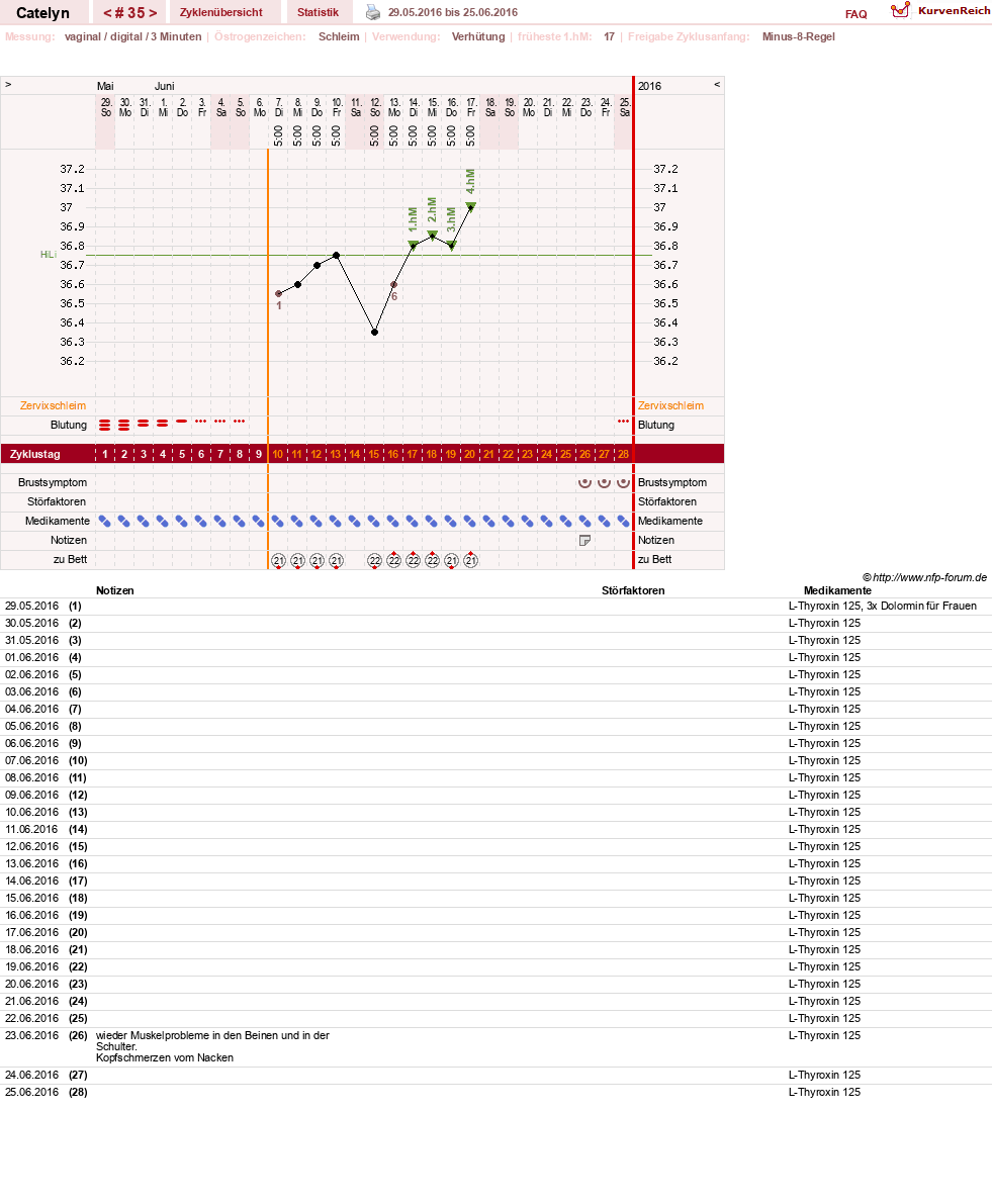 NFP-Kurve User #24125