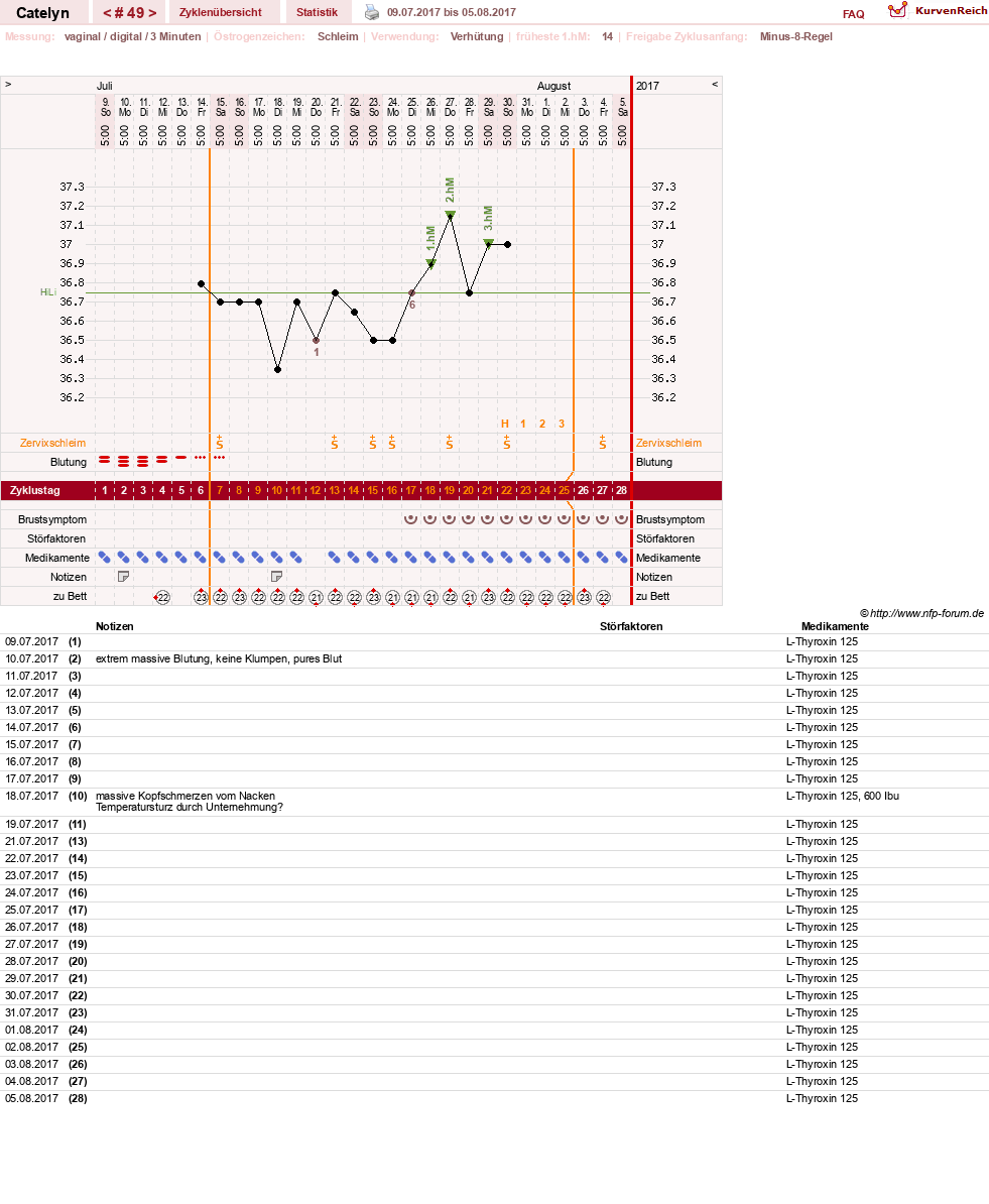 NFP-Kurve User #24125