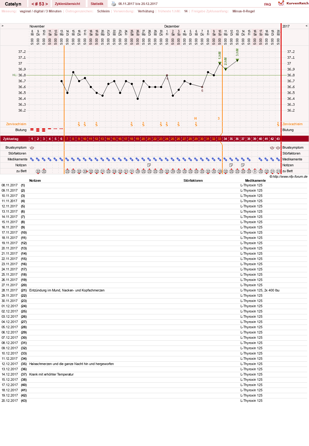 NFP-Kurve User #24125