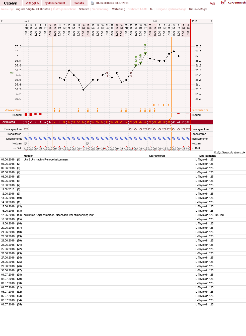 NFP-Kurve User #24125