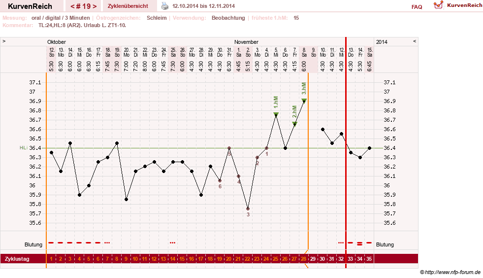 NFP-Kurve User #24156