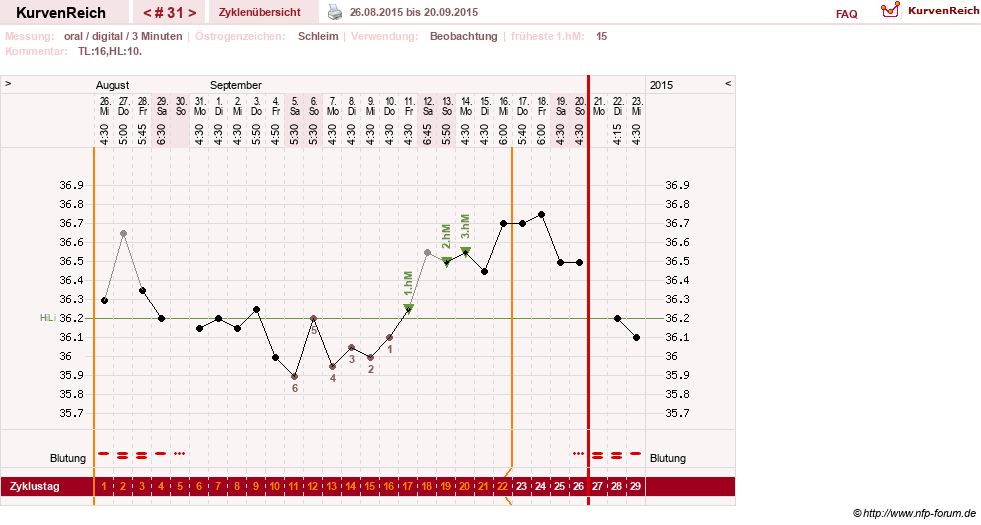 NFP-Kurve User #24156