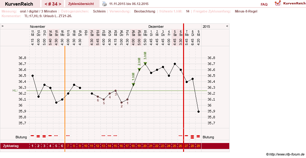 NFP-Kurve User #24156