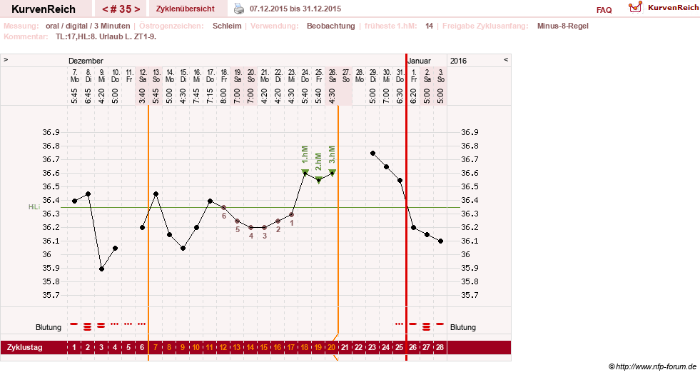 NFP-Kurve User #24156