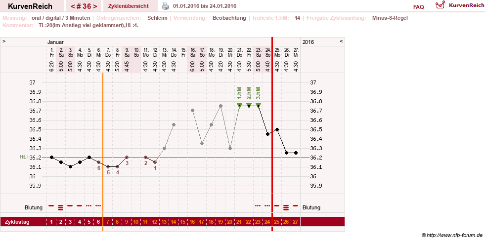 NFP-Kurve User #24156