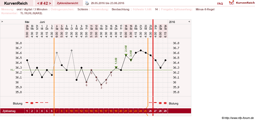 NFP-Kurve User #24156