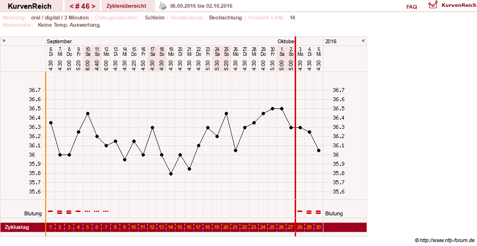 NFP-Kurve User #24156