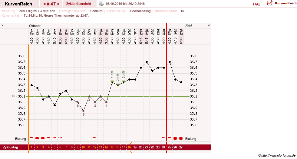 NFP-Kurve User #24156
