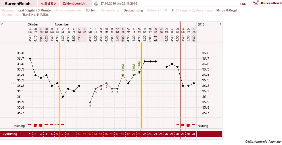 NFP-Kurve User #24156