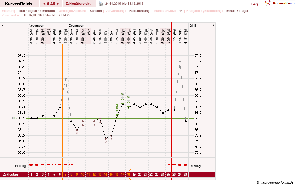 NFP-Kurve User #24156