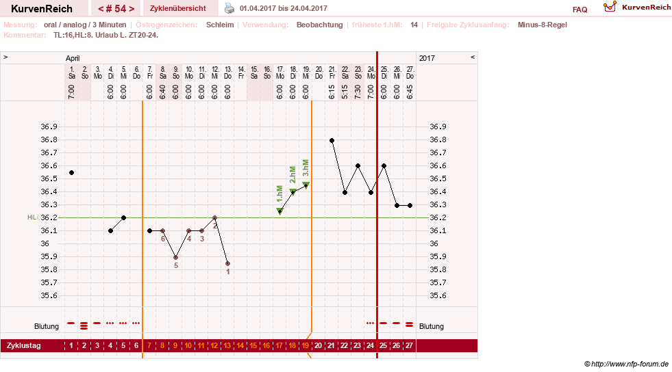 NFP-Kurve User #24156