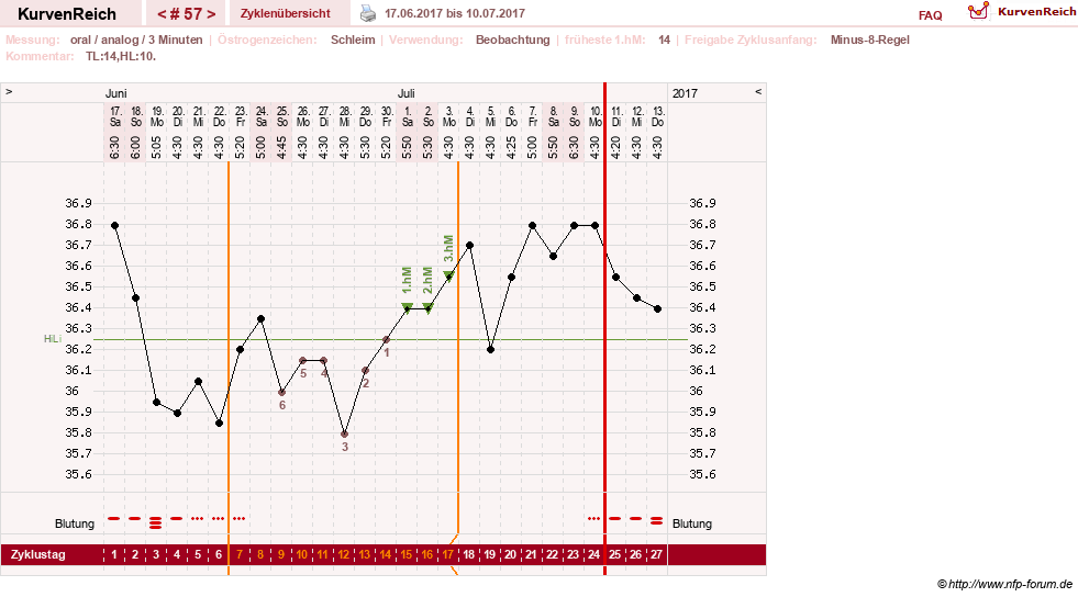 NFP-Kurve User #24156