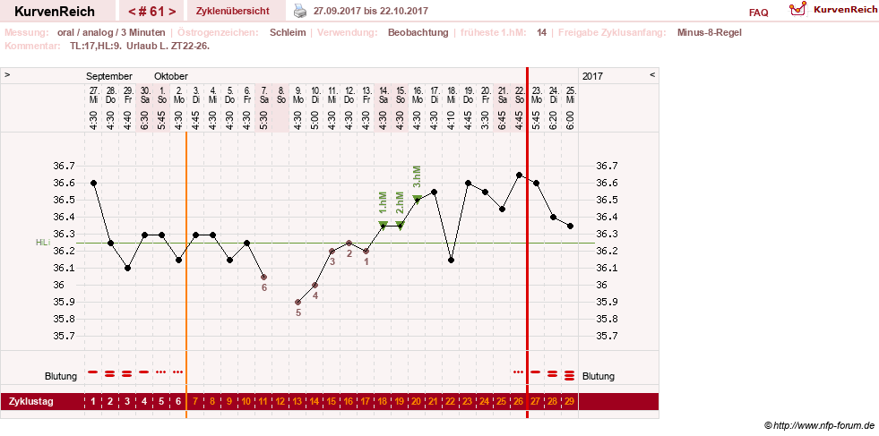 NFP-Kurve User #24156