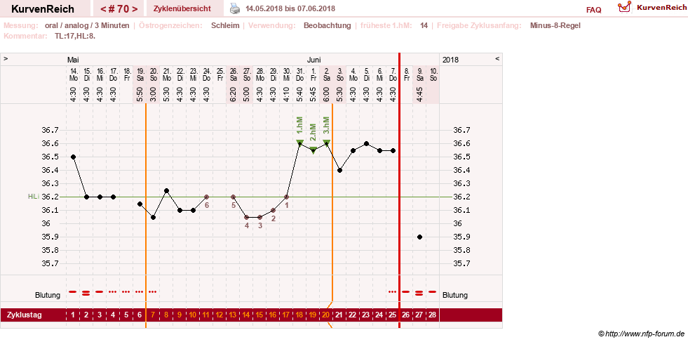 NFP-Kurve User #24156