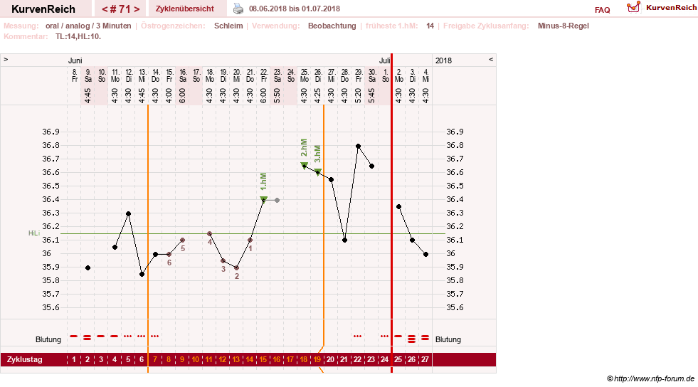 NFP-Kurve User #24156