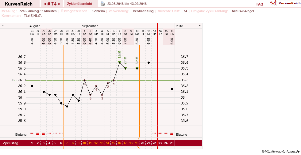 NFP-Kurve User #24156