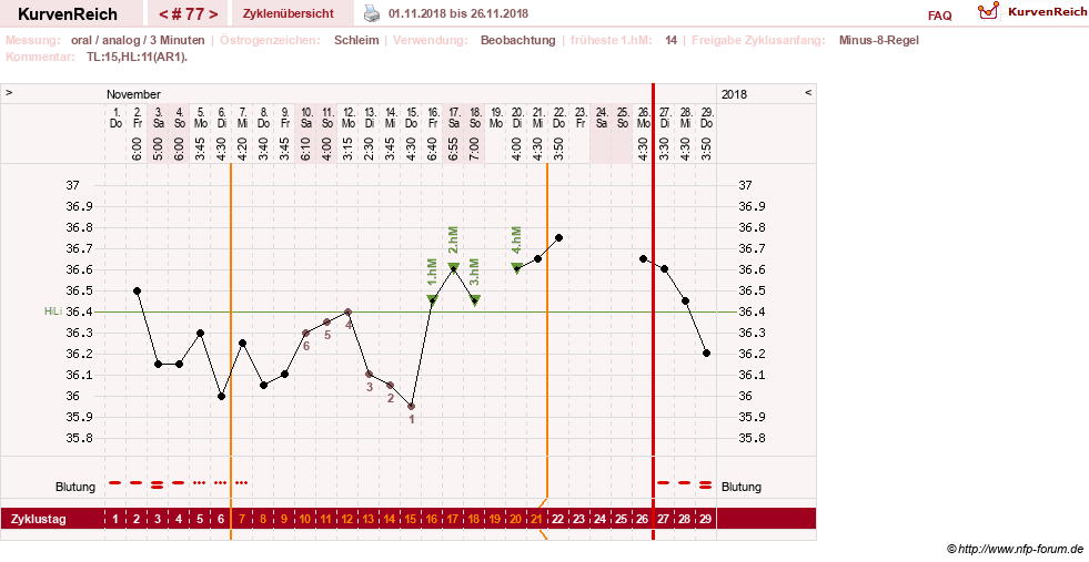 NFP-Kurve User #24156