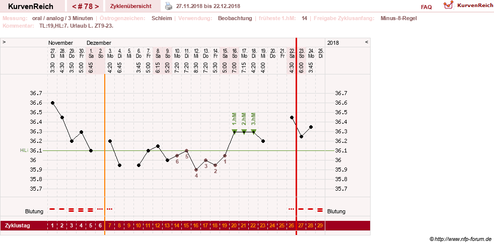 NFP-Kurve User #24156