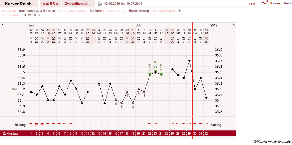 NFP-Kurve User #24156