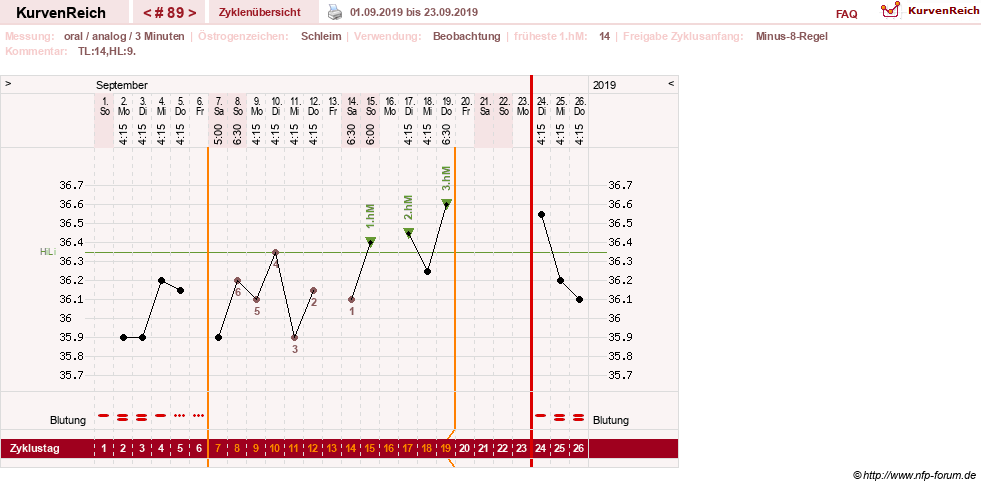 NFP-Kurve User #24156