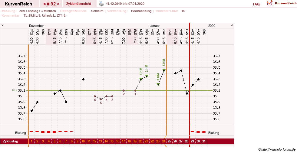 NFP-Kurve User #24156
