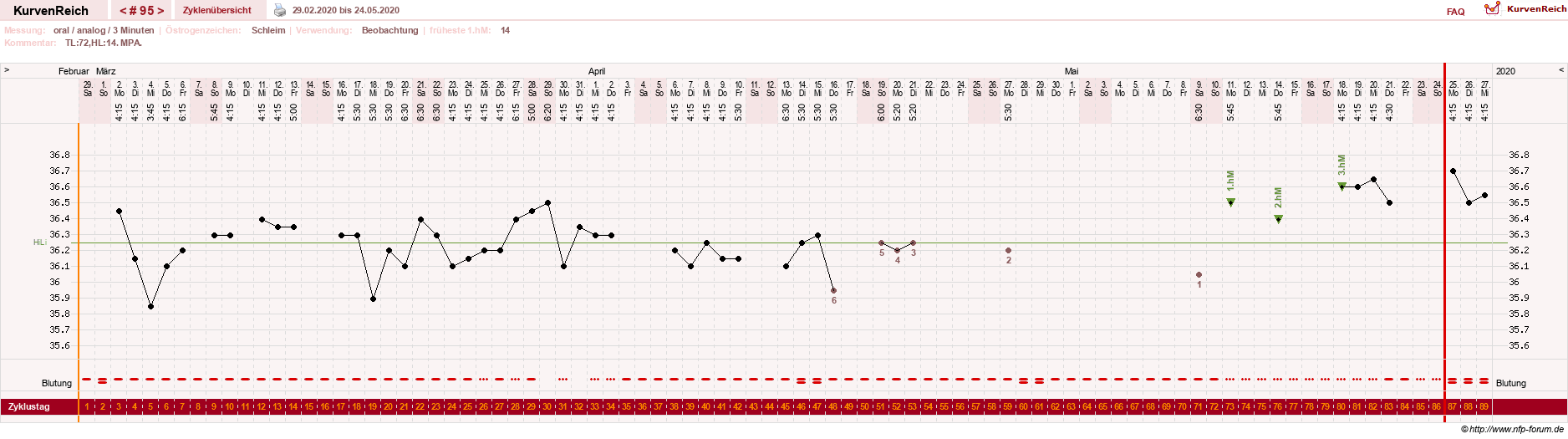 NFP-Kurve User #24156