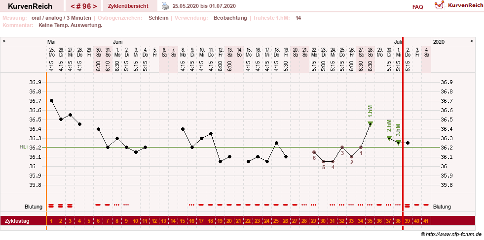 NFP-Kurve User #24156