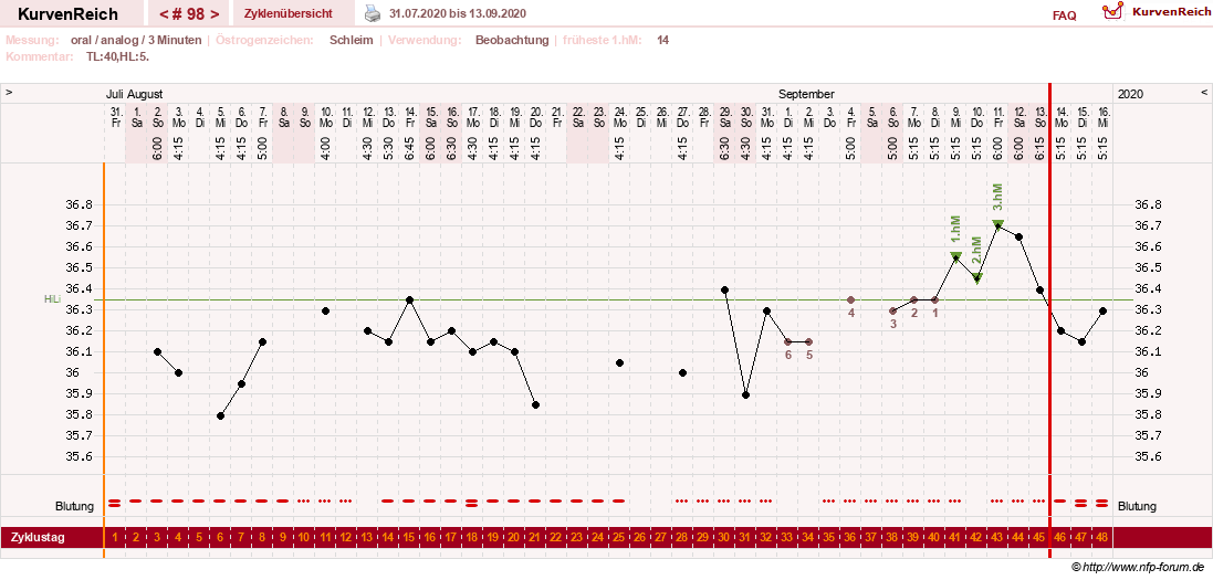 NFP-Kurve User #24156