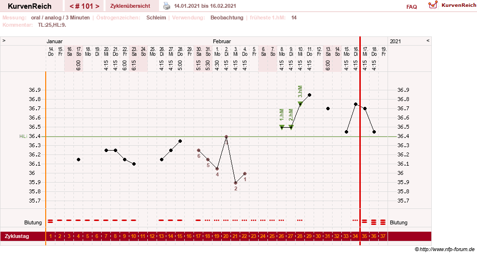 NFP-Kurve User #24156