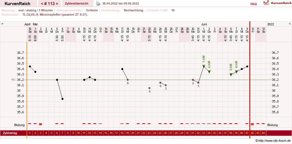 NFP-Kurve User #24156
