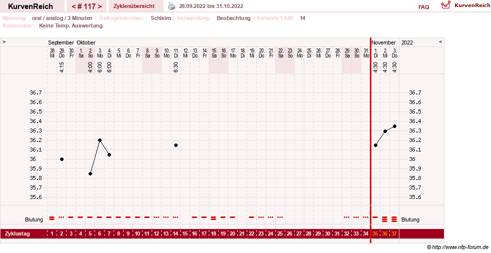 NFP-Kurve User #24156