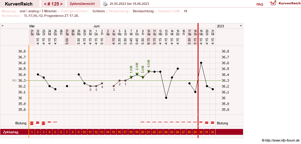 NFP-Kurve User #24156