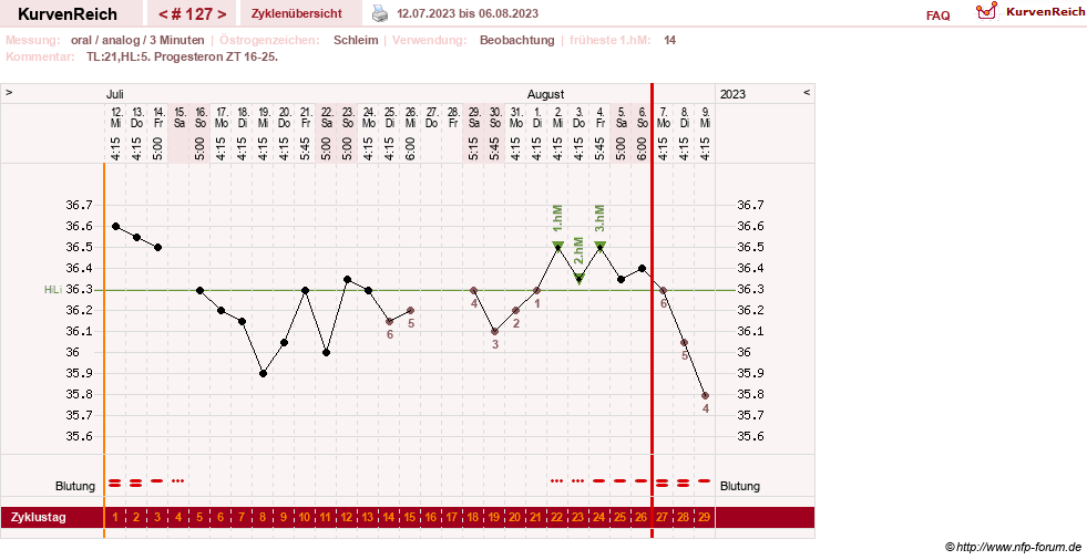 NFP-Kurve User #24156